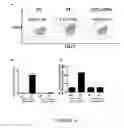 Fig. 05 - Methods and compositions for modulating cancer stem cells