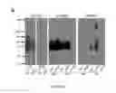 Fig. 03 - VEHICLE FOR DELIVERING A COMPOUND TO A MUCOUS MEMBRANE AND RELATED COMPOSITIONS, METHODS AND SYSTEMS