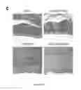 Fig. 08 - VEHICLE FOR DELIVERING A COMPOUND TO A MUCOUS MEMBRANE AND RELATED COMPOSITIONS, METHODS AND SYSTEMS