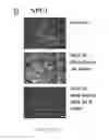 Fig. 22 - Compositions and their use for removing cholesterol