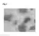 Fig. 02 - Core-Shell Crosslinked Hyaluronic Acid Gel Particles, Production Method for Same, and Medical Material