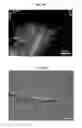 Fig. 09 - Methods for generation of podocytes from pluripotent stem cells and cells produced by the same