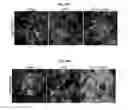 Fig. 14 - Methods for generation of podocytes from pluripotent stem cells and cells produced by the same
