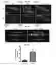 Fig. 15 - Methods for generation of podocytes from pluripotent stem cells and cells produced by the same