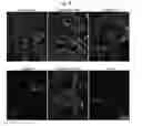 Fig. 16 - Methods for generation of podocytes from pluripotent stem cells and cells produced by the same