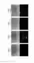 Fig. 12 - Gene-modified coxsackievirus