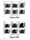 Fig. 15 - Molecular and herbal combinations for treating psoriasis