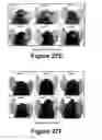 Fig. 17 - Molecular and herbal combinations for treating psoriasis