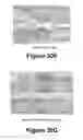 Fig. 22 - Molecular and herbal combinations for treating psoriasis