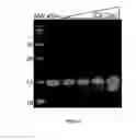 Fig. 06 - ICE-CLEAVED ALPHA-SYNUCLEIN AS A BIOMARKER