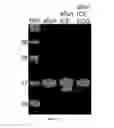 Fig. 07 - ICE-CLEAVED ALPHA-SYNUCLEIN AS A BIOMARKER