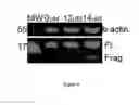 Fig. 10 - ICE-CLEAVED ALPHA-SYNUCLEIN AS A BIOMARKER