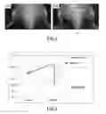 Fig. 03 - COMPOSITION FOR NEW BONE FORMATION, AND NEW BONE FORMATION SYSTEM