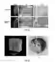 Fig. 04 - COMPOSITION FOR NEW BONE FORMATION, AND NEW BONE FORMATION SYSTEM