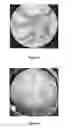 Fig. 03 - Method for crosslinking hyaluronic acid; method for preparing an injectable hydrogel; hydrogel obtained; use of the obtained hydrogel