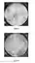 Fig. 04 - Method for crosslinking hyaluronic acid; method for preparing an injectable hydrogel; hydrogel obtained; use of the obtained hydrogel