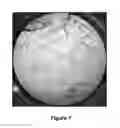Fig. 05 - Method for crosslinking hyaluronic acid; method for preparing an injectable hydrogel; hydrogel obtained; use of the obtained hydrogel