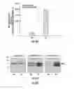 Fig. 08 - GENE THERAPY VECTOR FOR TREATMENT OF STEROID GLAUCOMA