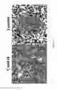 Fig. 33 - Compositions and Imaging Methods Comprising Detectably Labeled Phosphatidylethanolamine-Binding Peptides