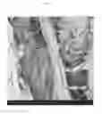 Fig. 04 - Biomimetic collagen-hydroxyapatite composite material