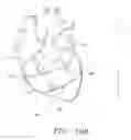 Fig. 14 - Biological Constructs for Treating Damaged Organs and Tissue