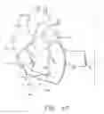 Fig. 12 - Biological Constructs for Treating Damaged Organs and Tissue