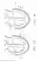 Fig. 15 - Biological Constructs for Treating Damaged Organs and Tissue