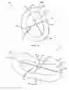 Fig. 05 - Bone matrix compositions and methods