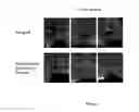 Fig. 06 - Bone matrix compositions and methods