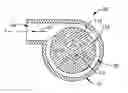 Fig. 01 - Heart assist device