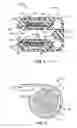 Fig. 06 - Heart assist device