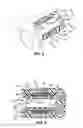 Fig. 07 - Heart assist device
