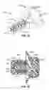 Fig. 10 - Heart assist device