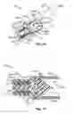 Fig. 11 - Heart assist device