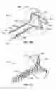 Fig. 13 - Heart assist device