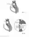 Fig. 03 - Electroactive actuators