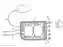 Fig. 01 - Medical treatment system and methods using a plurality of fluid lines