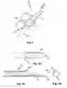 Fig. 03 - Fluid conveyance safety devices, methods, and systems
