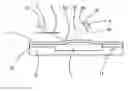 Fig. 01 - Sensor device for use in a medical fluid delivery system