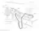 Fig. 01 - A PATIENT INTERFACE SYSTEM FOR TREATMENT OF RESPIRATORY DISORDERS