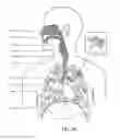 Fig. 03 - A PATIENT INTERFACE SYSTEM FOR TREATMENT OF RESPIRATORY DISORDERS