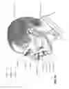 Fig. 06 - A PATIENT INTERFACE SYSTEM FOR TREATMENT OF RESPIRATORY DISORDERS