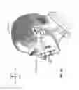 Fig. 07 - A PATIENT INTERFACE SYSTEM FOR TREATMENT OF RESPIRATORY DISORDERS