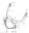 Fig. 55 - A PATIENT INTERFACE SYSTEM FOR TREATMENT OF RESPIRATORY DISORDERS