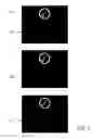 Fig. 03 - Breathing assistance apparatus user interface