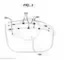 Fig. 04 - LIGHT THERAPY SYSTEM INCLUDING SPECTACLE FRAMES AND CONTACT LENSES