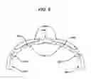 Fig. 10 - LIGHT THERAPY SYSTEM INCLUDING SPECTACLE FRAMES AND CONTACT LENSES