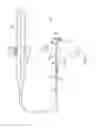 Fig. 02 - Catheter with improved torque transmission