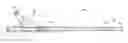 Fig. 01 - OCCLUSION SHEATH FOR IMAGING CATHETER