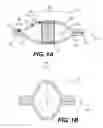Fig. 02 - INFLATABLE DEVICE WITH ETCHED MODIFICATIONS